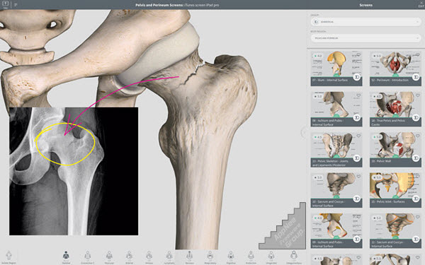 3d 4 medical complete anatomy