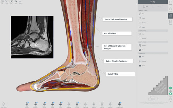 3d4medical complete anatomy mac torrent